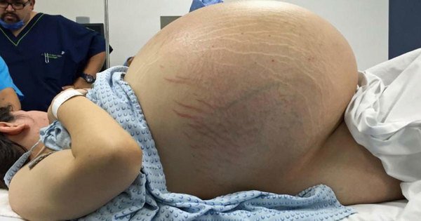 Une femme de 24 ans se rend à l’hôpital d’urgence et découvre un problème inquiétant