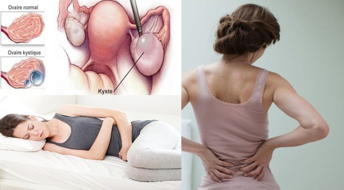 Si vous remarquez l’un de ces signes, vous avez peut-être ce problème féminin très fréquent