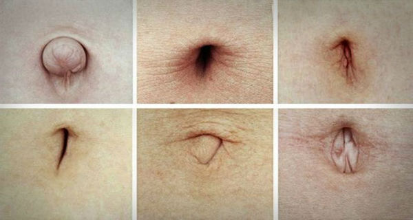 Si vous avez l’un de ces types de nombril, vous voulez lire ceci!