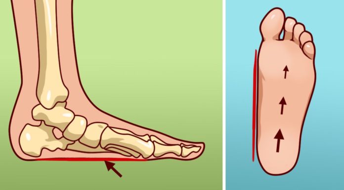 10 raisons pour lesquelles vos pieds font mal tout le temps et comment régler le problème