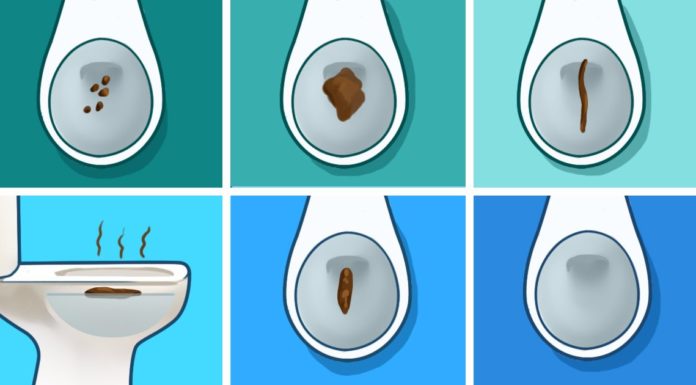 Vous n’en reviendrez pas de tout ce que vos selles peuvent dire sur votre santé!