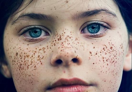 Voici comment faire disparaître naturellement les taches de rousseur sur le visage