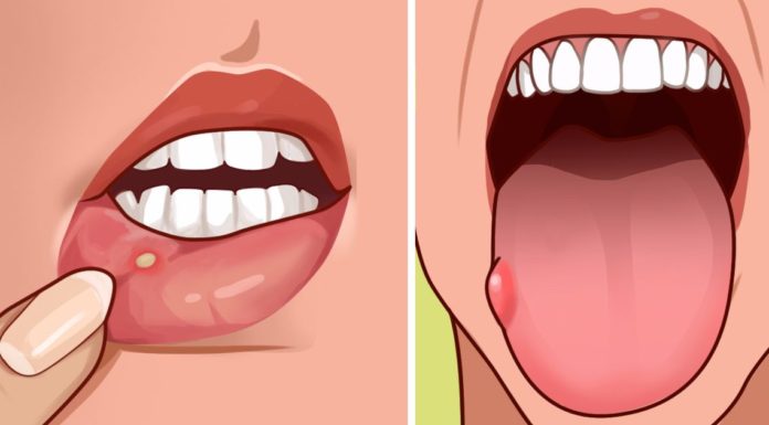 Ne négligez plus ces symptômes, ils vous avertissent d’une déficience importante dans votre corps!